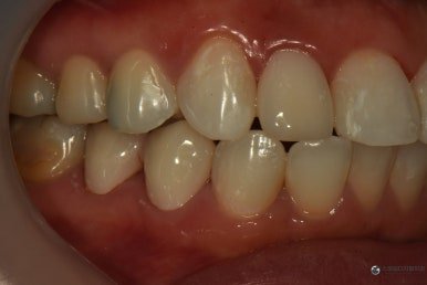 October 6, 2026 · Record of oral condition after treatment 1