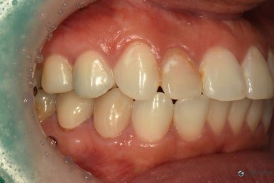 October 5, 2026 · Record of oral condition before treatment 1