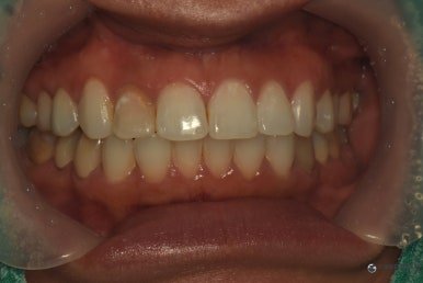 October 5, 2026 · Record of oral condition before treatment 2