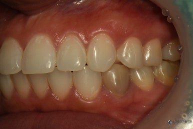 October 5, 2026 · Record of oral condition before treatment 3