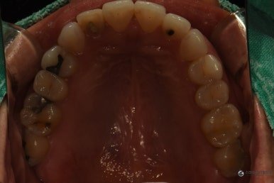 October 5, 2026 · Record of the biting surfaces of the upper and lower teeth 1