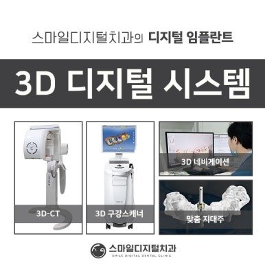 스마일디지털치과 3D 디지털 임플란트 시스템 안내 이미지
