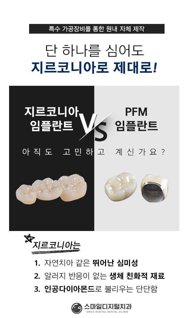 지르코니아 임플란트와 PFM 임플란트 비교 안내 이미지