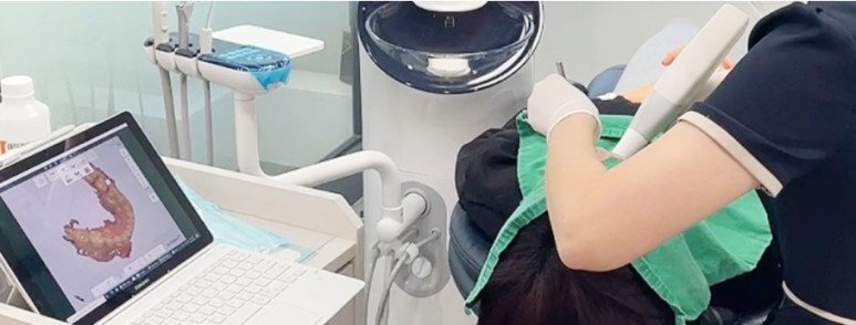 구강스캐너로 구강을 스캔하는 모습