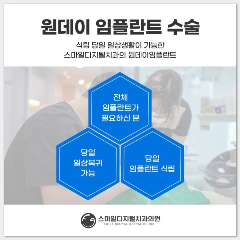 원데이 임플란트 수술 안내 이미지