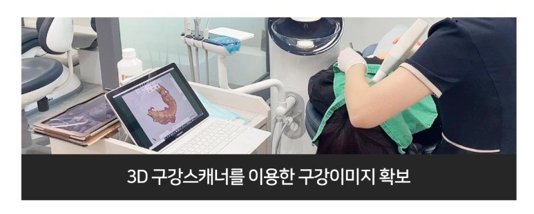 구강스캐너로 치아를 스캔하는 모습